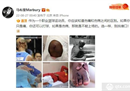 马布里拍了很多伤病的照片，但是不经历风雨怎么见彩虹？